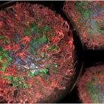 Scientist Develops Bioinformatics Program To Study Intrinsically Disordered Proteins