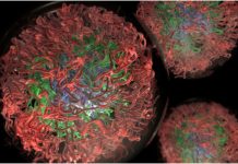 Scientist Develops Bioinformatics Program To Study Intrinsically Disordered Proteins