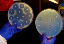 New Antibiotic Susceptibility Test Detects Resistance In Less Than 30 Minutes