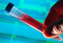 D4 lab-on-a-chip can detect disease in 15 minutes !