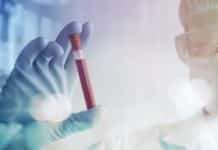 Blood Biopsy : Technique That Reads Thrombocytes In Blood To Detect Lung Cancer