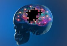 Scientists Re-purpose Diabetes Drug To Treat Parkinson’s A new potential for alzheimer’s has been identified by researchers- the protective “gatekeeper” cells of tiny blood vessels.