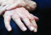 Tears Shed by Parkinson’s Patients Could Help Diagnose the Disease Early
