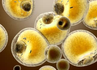 Landmark Study Links Brain Cholesterol to Alzheimer’s