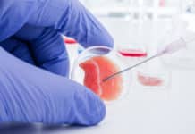 Pfizer’s stem cell therapy for blindness shelved