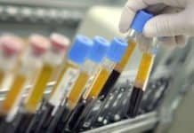 Cancer Drug Could Lend A Hand In Defeating HIV