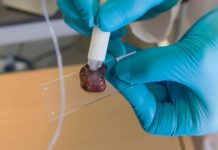 MasSpec Pen, A Handheld Device Capable Of Identifying Cancer Within Minutes