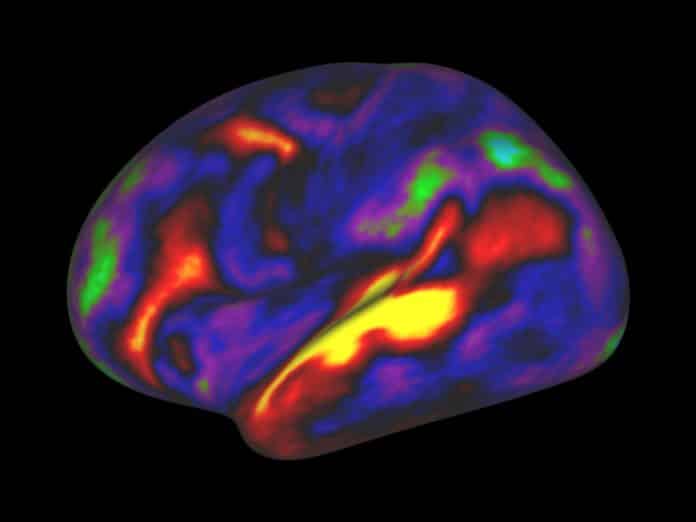 The Brain Re-Maps Its Visual Areas To Process Language In Blind People