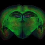 Molecule Discovered Targets Inflammatory Implicated In Cancer