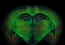 New Molecule Discovered Targets Inflammatory Response Implicated In Alzheimer’s & Cancer Molecule Discovered Targets Inflammatory Implicated In Cancer