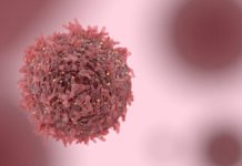 Scientists Blast Away Tumour Cells Using Laser Directed Gold Nanoparticles