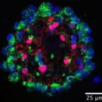 Mapping Cells to Provide Drug Targets For Lung Disorders