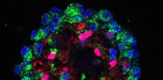 Mapping Cells to Provide Drug Targets For Lung Disorders