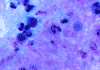 Parasite Decides To Strike Is Big Deal With Respect To The Infections