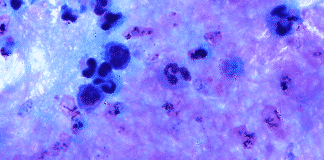 Parasite Decides To Strike Is Big Deal With Respect To The Infections