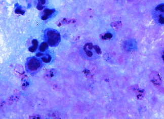 Parasite Decides To Strike Is Big Deal With Respect To The Infections