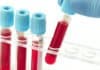 Pain Therapeutics Swoops Up $4 Million For Alzheimer’s Blood Test And Fentanyl-Based Patch Pain Therapeutics Swoops Up $4 Million For Alzheimer's Blood Test