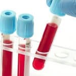 Pain Therapeutics Swoops Up $4 Million For Alzheimer's Blood Test