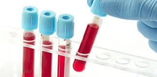 Pain Therapeutics Swoops Up $4 Million For Alzheimer's Blood Test