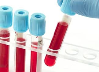 Pain Therapeutics Swoops Up $4 Million For Alzheimer's Blood Test