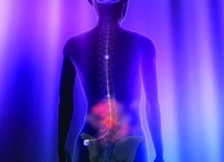 USFDA Approves Medtronic’s 'Next-Generation' Spinal Cord Stimulator