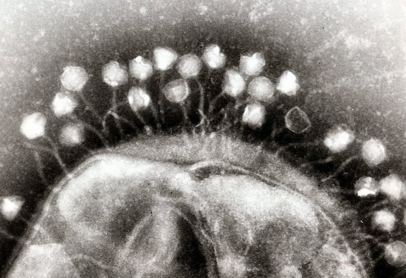 Century Old Viruses May Be Our Best Bet Against Antibiotic Resistance