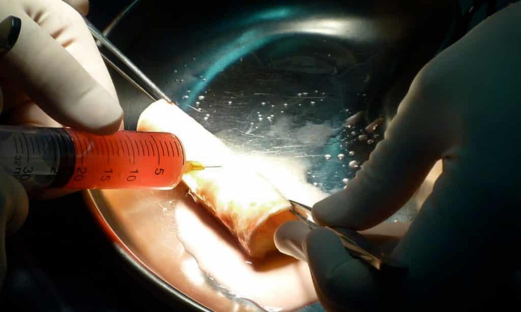 Unapproved Implants Used In Surgery On Human “Guinea Pigs”