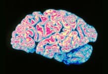 Key Parkinson’s Protein Structure Uncovered, New Drugs against Disease on the Horizon Key Parkinson’s Protein Structure Uncovered, New Drugs on the Horizon