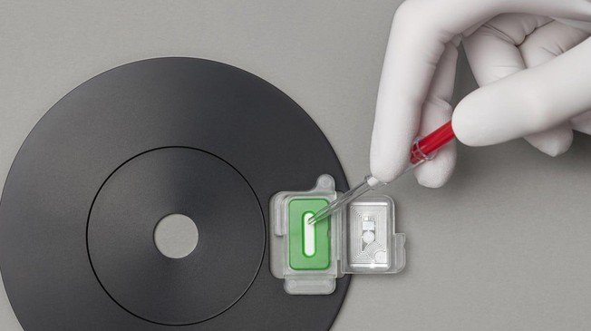 FDA Approves Abionic’s 5-minute Allergy Test - Pharma testing