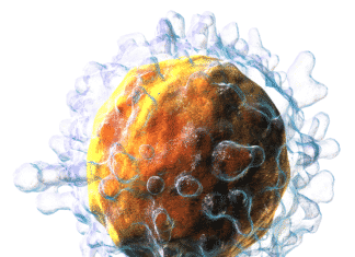 A Glitch in T cell Regulatory Pathway Could Contribute to MS