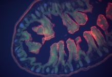 Scientists Implant Stem-Cell-Derived Small Bowel Segments Into Rats Scientists Implant Stem-Cell-Derived Small Bowel Segments Into Rats