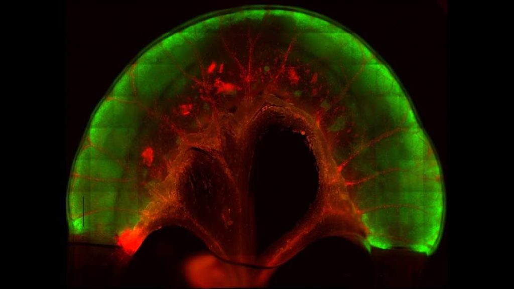 Scientists Implant Stem-Cell-Derived Small Bowel Segments Into Rats