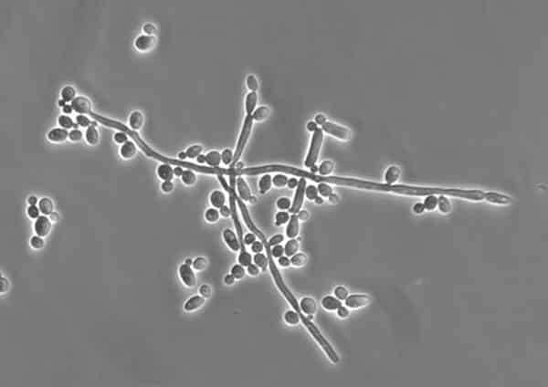 CRISPR Aids in Driving Out Drug Resistance in Fungal Pathogen