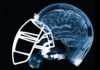 Study Unravels CTE Biomarker, Paves Way For Diagnosis In Players
