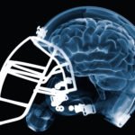 Study Unravels CTE Biomarker, Paves Way For Diagnosis In Players