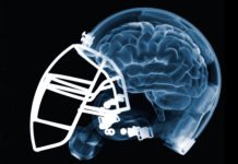 Study Unravels CTE Biomarker, Paves Way For Diagnosis In Players While Still Alive Study Unravels CTE Biomarker, Paves Way For Diagnosis In Players