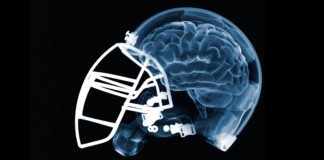 Study Unravels CTE Biomarker, Paves Way For Diagnosis In Players