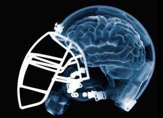 Study Unravels CTE Biomarker, Paves Way For Diagnosis In Players