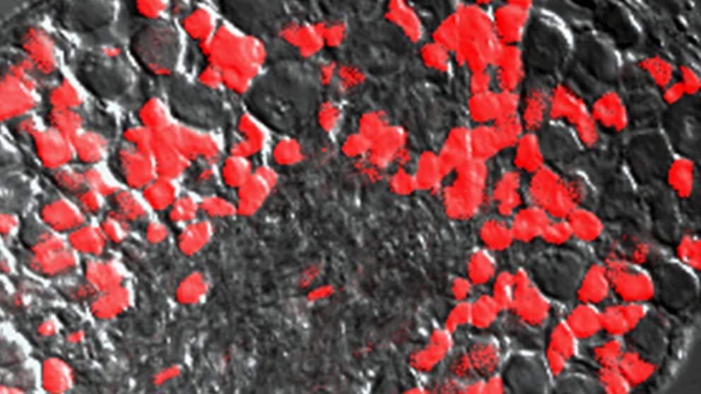 Study Exonerates “Gatekeeper” Neurotransmitters In Pain Transmission