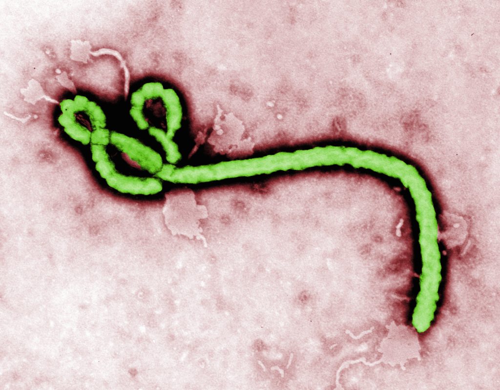 China Approves Domestically-Developed Ebola Vaccine, Third Country to Do So
