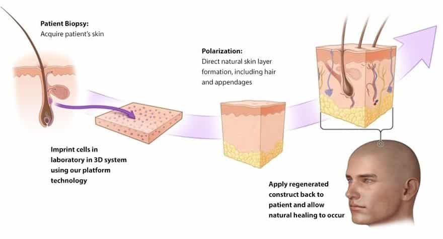 PolarityTE Announces U.S. FDA Registration Of Its Skin-Regeneration Platform