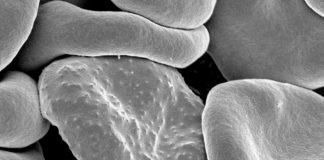 AI-Aided Microscope Boosts Malaria Diagnosis