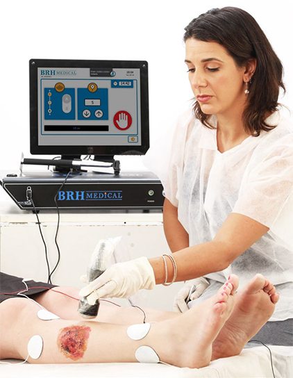  Ultrasound and Electric Field Stimulation to Treat Chronic Wounds