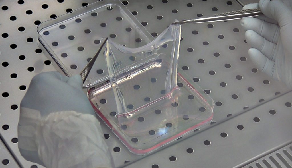 In A First, Scientists Give Boy Suffering From JEB Entirely New Skin Using Gene Therapy