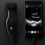Smartphone-Connected Ultrasound-On-a-Chip Greenlit by FDA