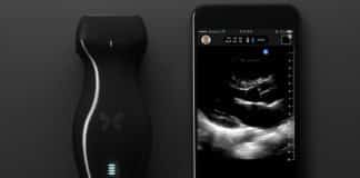 Smartphone-Connected Ultrasound-On-a-Chip Greenlit by FDA
