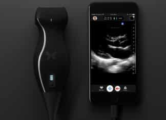 Affordably-Prized, Smartphone-Connected Ultrasound-On-a-Chip Greenlit by FDA Smartphone-Connected Ultrasound-On-a-Chip Greenlit by FDA