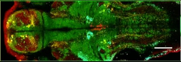 Brain’s Alertness Attributable to Ancestral Circuitry