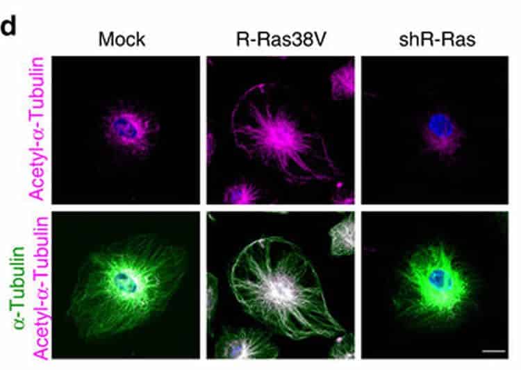 New Study Provides Insights into Regeneration of Blood Vessels