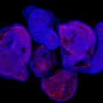 Mini Digestive Tract Found inside Cancerous Cells